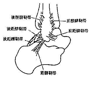 足関節捻挫について教えて下さい。